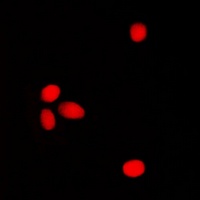 ELF1 Rabbit Polyclonal Antibody