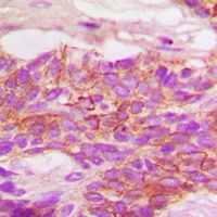 HER2 (Phospho-Y1248) Antibody