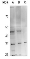 FGF13 Rabbit Polyclonal Antibody
