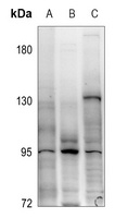 FGFR4 Rabbit Polyclonal Antibody