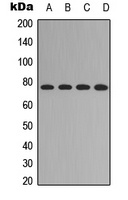 FOXO1 (Phospho-S329) Antibody