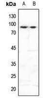 FOXO3 (Phospho-S253) Antibody