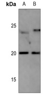 CD306 Rabbit Polyclonal Antibody