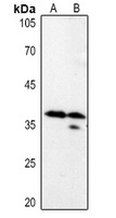 LASP1 Rabbit Polyclonal Antibody