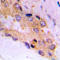 mTOR (Phospho-S2448) Antibody