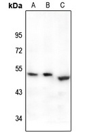 EP2 Rabbit Polyclonal Antibody