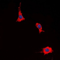 EP2 Rabbit Polyclonal Antibody