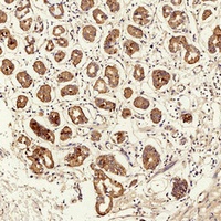 TIMP1 Rabbit Polyclonal Antibody