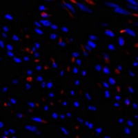 TIMP1 Rabbit Polyclonal Antibody