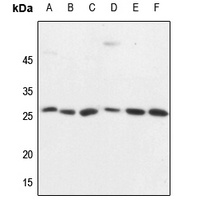 CD137 Rabbit Polyclonal Antibody