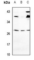 VTI1A Rabbit Polyclonal Antibody