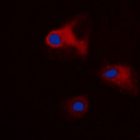 14-3-3 theta/tau (Phospho-S232) Antibody