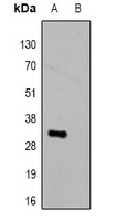 HSV-tag Rabbit Polyclonal Antibody