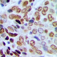 HP1 gamma (Phospho-S93) Antibody