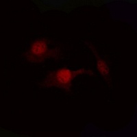PTEN (Phospho-S380/T382/T383) Antibody