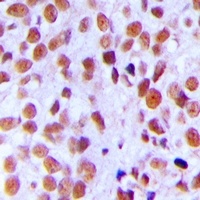 Ku80 (Phospho-T714) Antibody