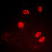 Ku80 (Phospho-T714) Antibody
