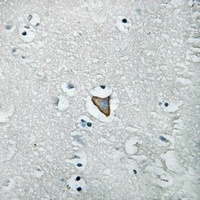 HER3 (Phospho-Y1222) Antibody