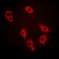 HER3 (Phospho-Y1222) Antibody