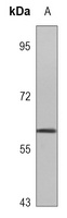 PHF1 Rabbit Polyclonal Antibody