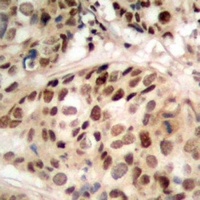 PHF1 Rabbit Polyclonal Antibody