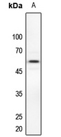 Dyskerin Rabbit Polyclonal Antibody