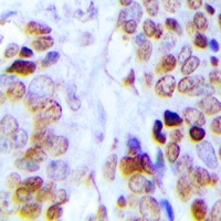 Dyskerin Rabbit Polyclonal Antibody