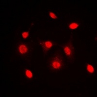 Dyskerin Rabbit Polyclonal Antibody