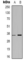 ZNF265 Rabbit Polyclonal Antibody