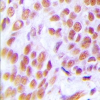 ZNF265 Rabbit Polyclonal Antibody