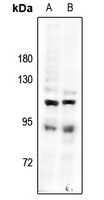 CDK11B Rabbit Polyclonal Antibody