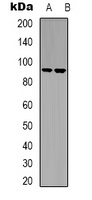LTK Rabbit Polyclonal Antibody