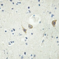 LTK Rabbit Polyclonal Antibody