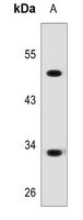 ZFP36L2 Rabbit Polyclonal Antibody