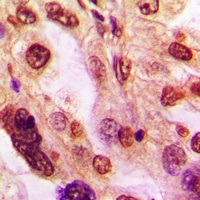 ZFP36L2 Rabbit Polyclonal Antibody