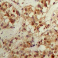CBFB Rabbit Polyclonal Antibody
