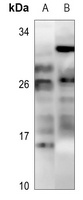 MOB3C Rabbit Polyclonal Antibody