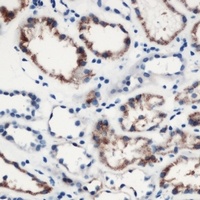 MOB3C Rabbit Polyclonal Antibody
