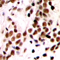 GTF2IRD1 Rabbit Polyclonal Antibody
