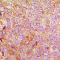 MRPL48 Rabbit Polyclonal Antibody