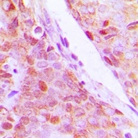 RPL5 Rabbit Polyclonal Antibody