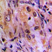 AKR1C2 Rabbit Polyclonal Antibody