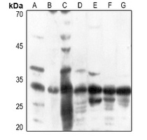 ATP5C1 Rabbit Polyclonal Antibody