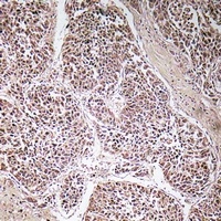 ATP5C1 Rabbit Polyclonal Antibody