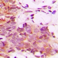 CNTROB Rabbit Polyclonal Antibody