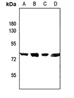 CEP78 Rabbit Polyclonal Antibody