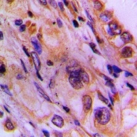 CEP78 Rabbit Polyclonal Antibody