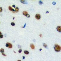 CstF-64T Rabbit Polyclonal Antibody