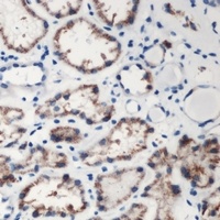 DMGDH Rabbit Polyclonal Antibody