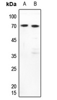 FUBP3 Rabbit Polyclonal Antibody